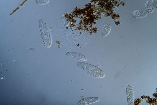 Plankton with microscopic ciliates