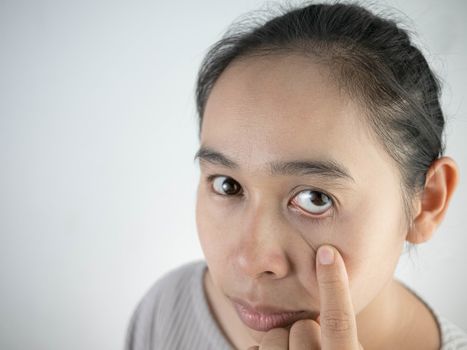 Asian woman is suffering of eye pain isolatedon grey background. Health care concept.