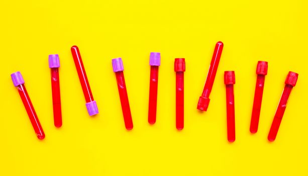 Blood in test tubes on yellow background. Copy space