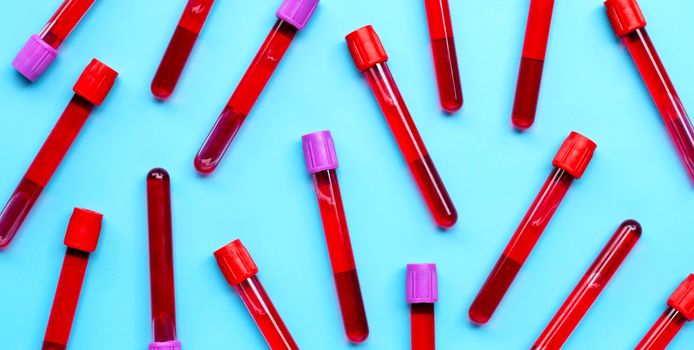Blood in test tubes on blue background. Top view