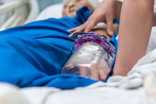 Patient in the hospital with saline intravenous and relatives patient hand holding a elderly patient hand with DIY restraint gloves