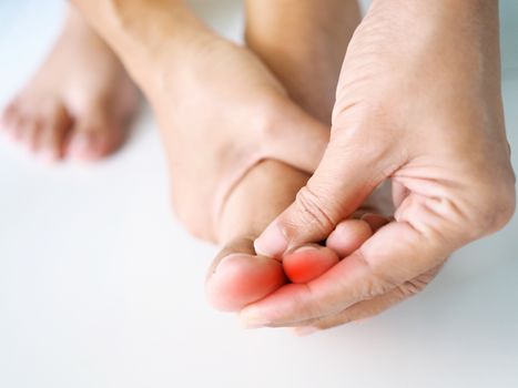Close-up young asian woman with painful and inflamed on toe of foot, medical symptom and healthcare concept.