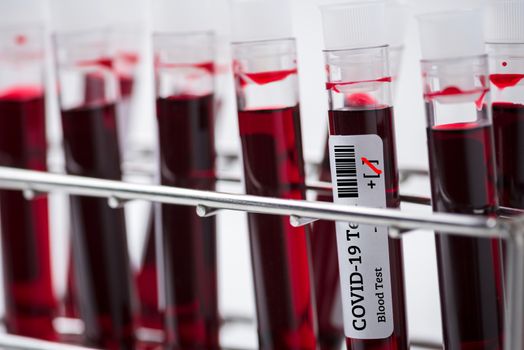 blood sample test tubes in laboratory rack , blood sample for COVID-19 test