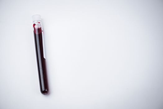 blood sample test tubes on white background , blood sample for COVID-19 test