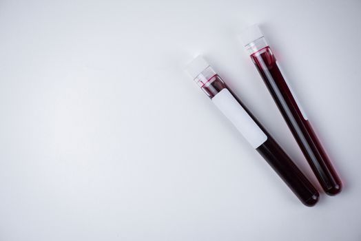 blood sample test tubes on white background , blood sample for COVID-19 test