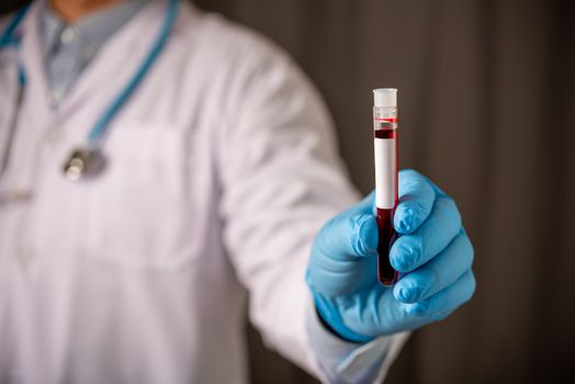 doctor hand wearing blue glove holding blood test tube