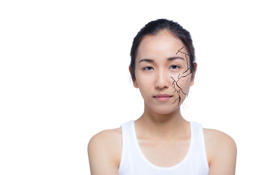 Closeup of woman cracked and damaged face as cosmetic and dehydration effect concept isolated on white background