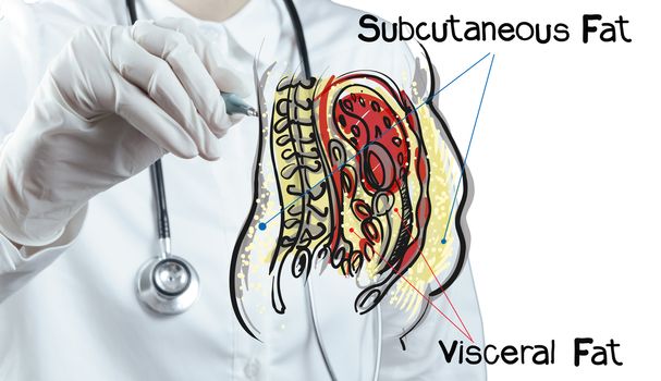 doctor draws abdominal fat as medical concept