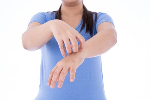 Female scratching her hand on isolated white background. Medical, healthcare for advertising concept.