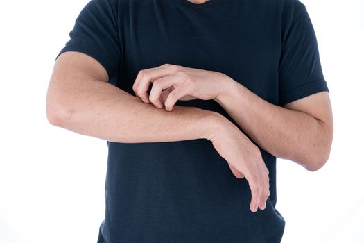 Male scratching his arm on isolated white background. Medical, healthcare for advertising concept.