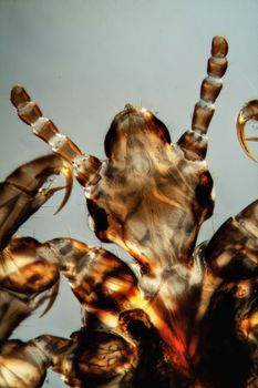 Head of the head louse with sucking mouth tools