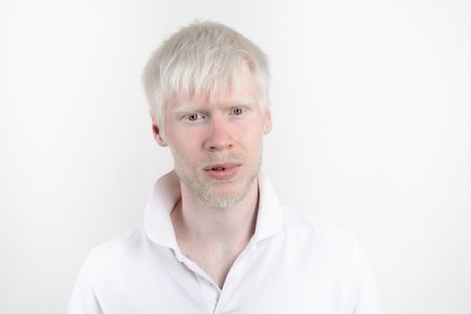 albinism albino man in studio dressed t-shirt isolated on a white background. abnormal deviations. unusual appearance. skin abnormality