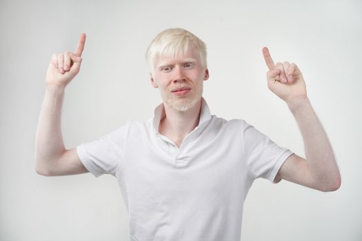 albinism albino man white skin hair studio dressed t-shirt isolated white background abnormal deviations unusual appearance abnormality Beautiful people Shows two fingers up.