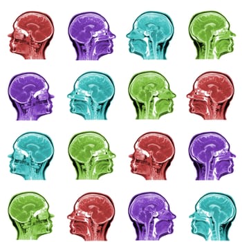 seamless pattern of MRI scans of sixty years old caucasian female head in sagittal or longitudinal plane - colored heads on white background.