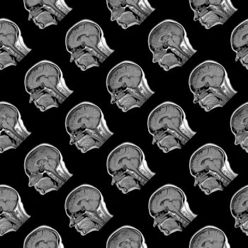 seamless regular pattern of sagittal MRI scans of sixty years old caucasian female head on black background