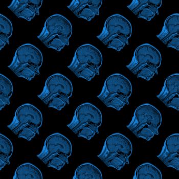 seamless pattern of serial MRI scans of sixty years old caucasian female head in sagittal or longitudinal plane - classic blue color on black background