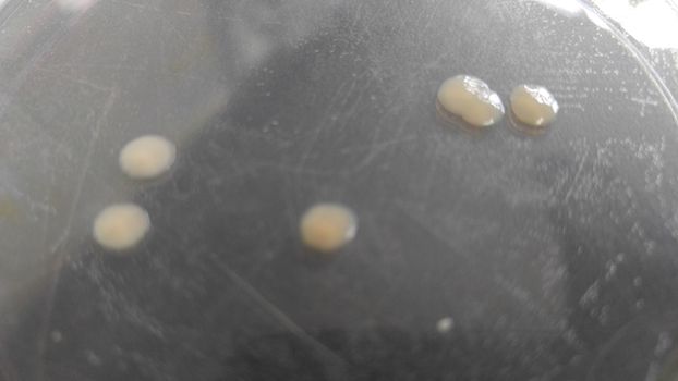 Petri dish with various bacteria colonies on agar