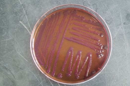 Petri dish with various bacteria colonies on agar. Selective focus view