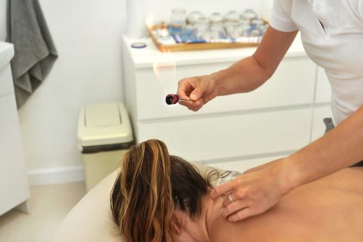 Young female physiotherapist applying glass suction banks on back of her patient, holding open flame above during cupping therapy, closeup detail.