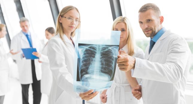 Team of experts doctors examining lungs X-ray report on hospital office meeting