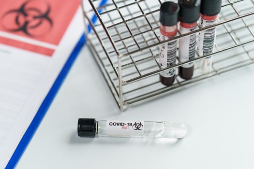 Blood test samples tube, reagent testing tube and swab collection kit in the laboratory, Coronavirus testing process. (Fake QR code and barcode)