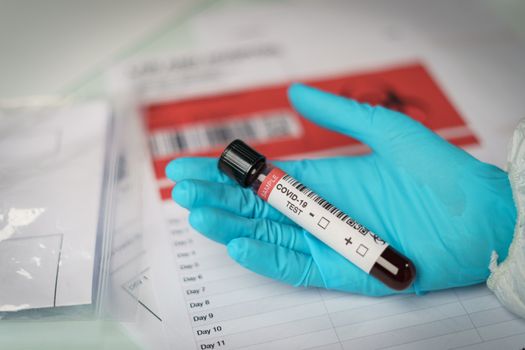 Coronavirus testing, a hand holds tube of blood test samples of coronavirus (COVID-19).