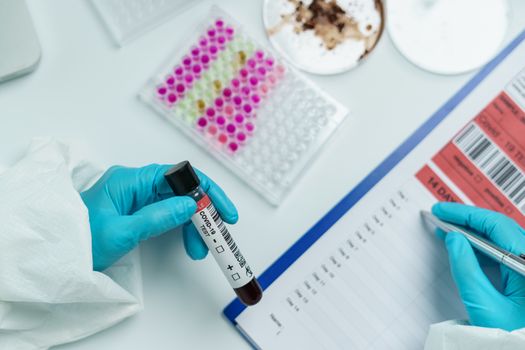 Scientist holding blood test samples tube in hand writing report information about blood test.Coronavirus testing process.