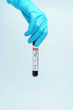Hand with blue glove holding blood test tube samples of coronavirus (COVID-19).