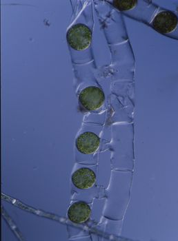 elongated green algae in the water under the microscope