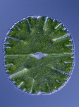 Ornamental algae Micrasterias in drops of water 100x