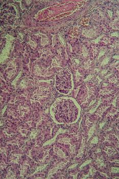 Cross section of the kidney with Glumeroli 100x