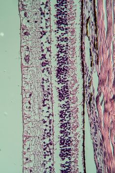 Cross-section through the retina 100x