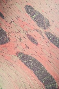 Sarcocystis spore animals in muscle, 200x