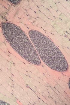 Sarcocystis spore animals in muscle, 200x