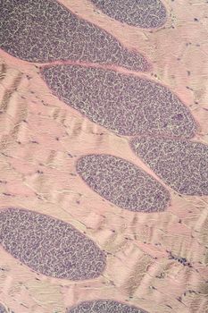 Sarcocystis spore animals in muscle, 200x