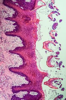 Monkey tongue across, papillae 100x