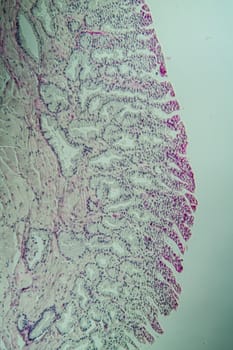 Toad cross section through the tongue 200x