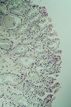 Toad cross section through the tongue 200x