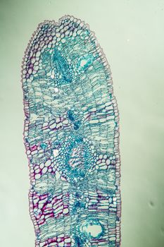 Eucalyptus cross section through leaf 100x