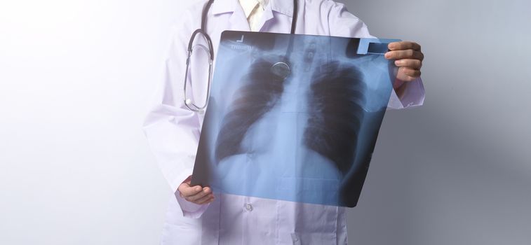 Asia woman doctor holding and checking up lung’s x-ray film or radiograph from coronavirus pandemic. doctor wearing hospital uniform and stethoscope on neck. studio shot and white background.