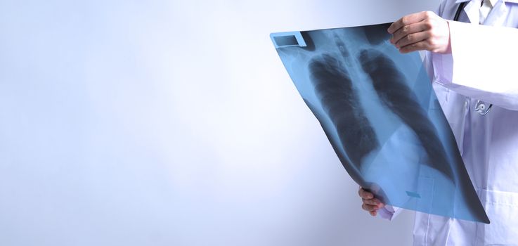 Asia woman doctor holding and checking up lung’s x-ray film or radiograph from coronavirus pandemic. doctor wearing hospital uniform and stethoscope on neck. studio shot and white background.