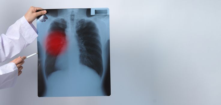 Asia woman doctor holding and checking up lung’s x-ray film or radiograph from coronavirus pandemic. doctor wearing hospital uniform and stethoscope on neck. studio shot and white background.