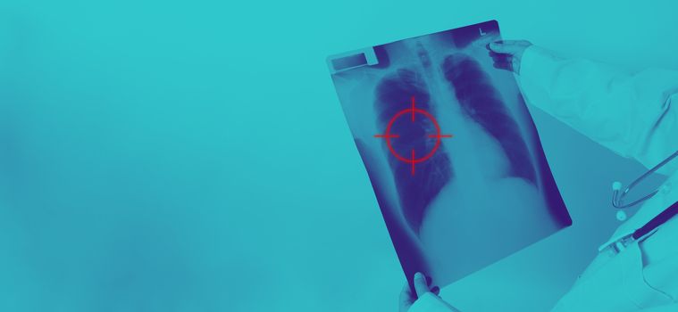 Asia woman doctor holding and checking up lung’s x-ray film or radiograph from coronavirus pandemic. doctor wearing hospital uniform and stethoscope on neck. studio shot and white background.