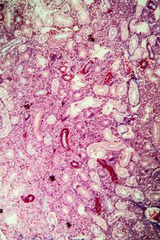 Pike kidney in cross section 100x