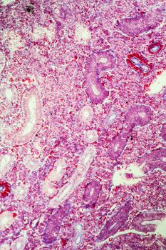 Pike kidney in cross section 100x