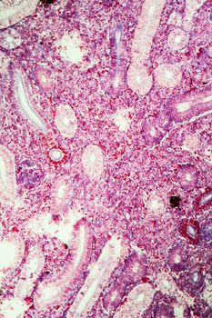 Pike kidney in cross section 100x