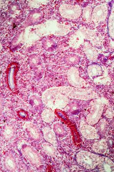 Pike kidney in cross section 100x