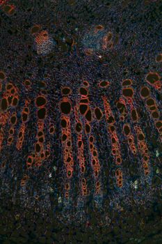 Bean stalk in cross section 100x