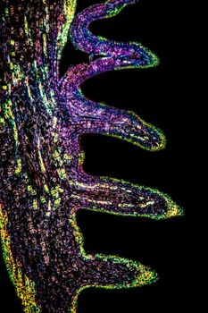 Horse chestnut buds in cross section 100x