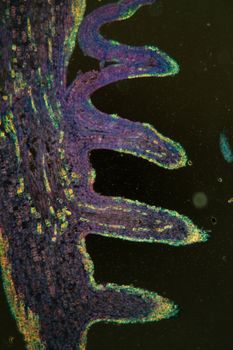 Horse chestnut buds in cross section 100x